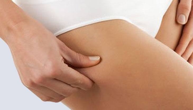 Lipoaspiration ou la liposuccion