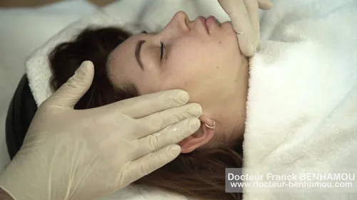 Massage après un lifting