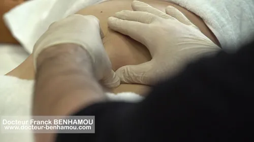 Massage apres lipoaspiration 16