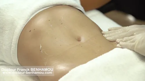 Massage après lipoaspiration 25
