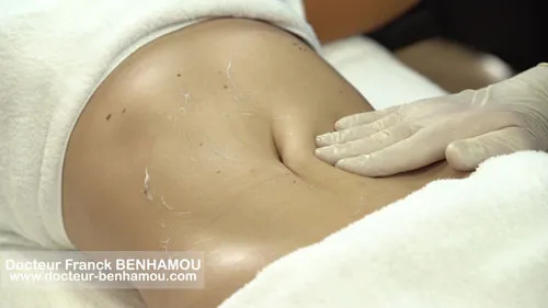 Massage après lipoaspiration 34