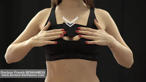 Soutien gorge après une augmentation mammaire