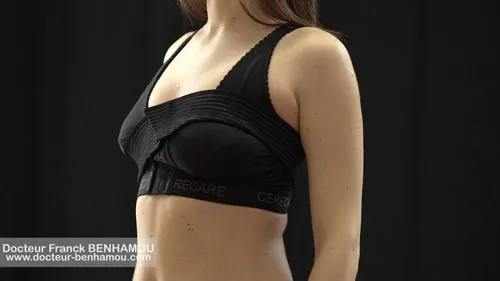Soutien gorge après une augmentation mammaire
