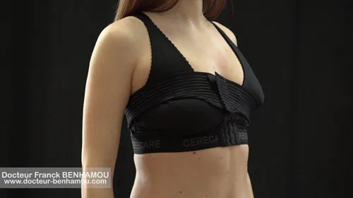 Soutien gorge après une augmentation mammaire