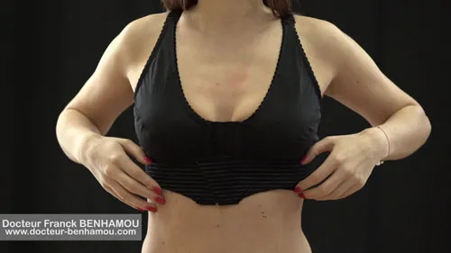 Soutien gorge après une augmentation mammaire