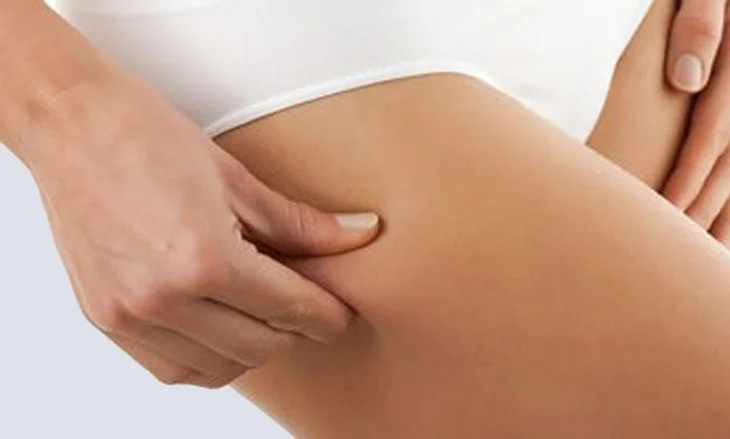 Chirurgie esthétique de la silhouette